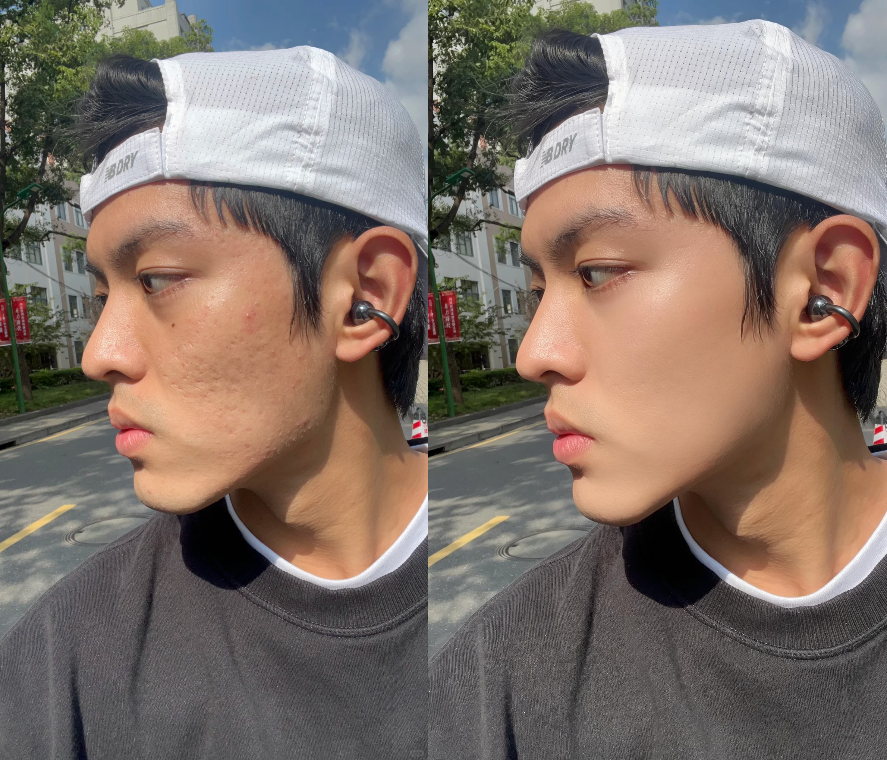 Lossless Detail Enhancement